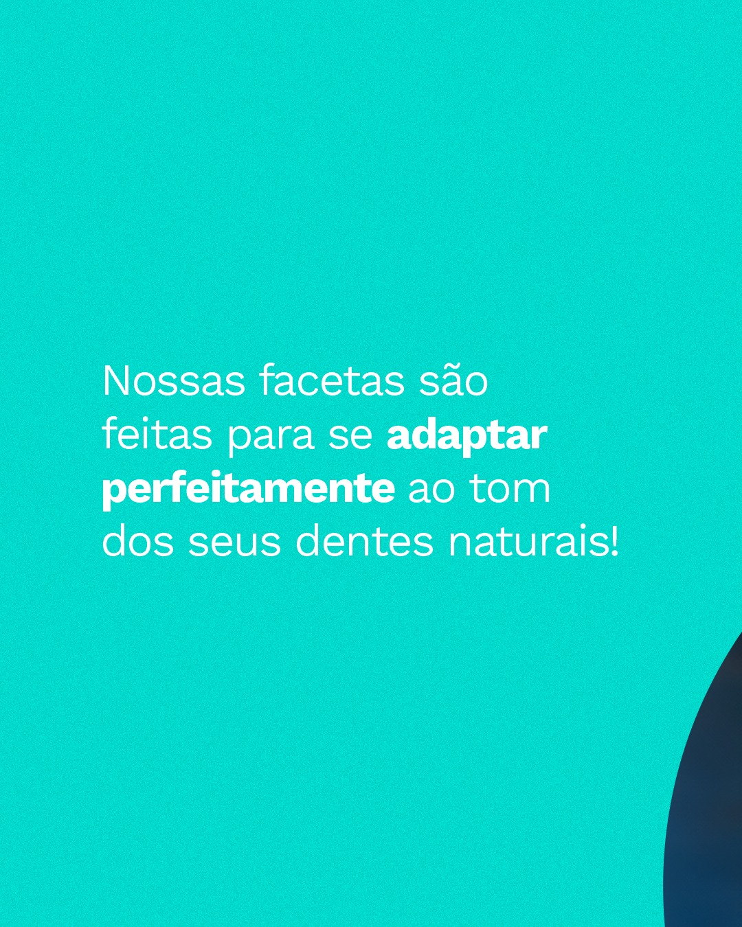 Facetas (2)